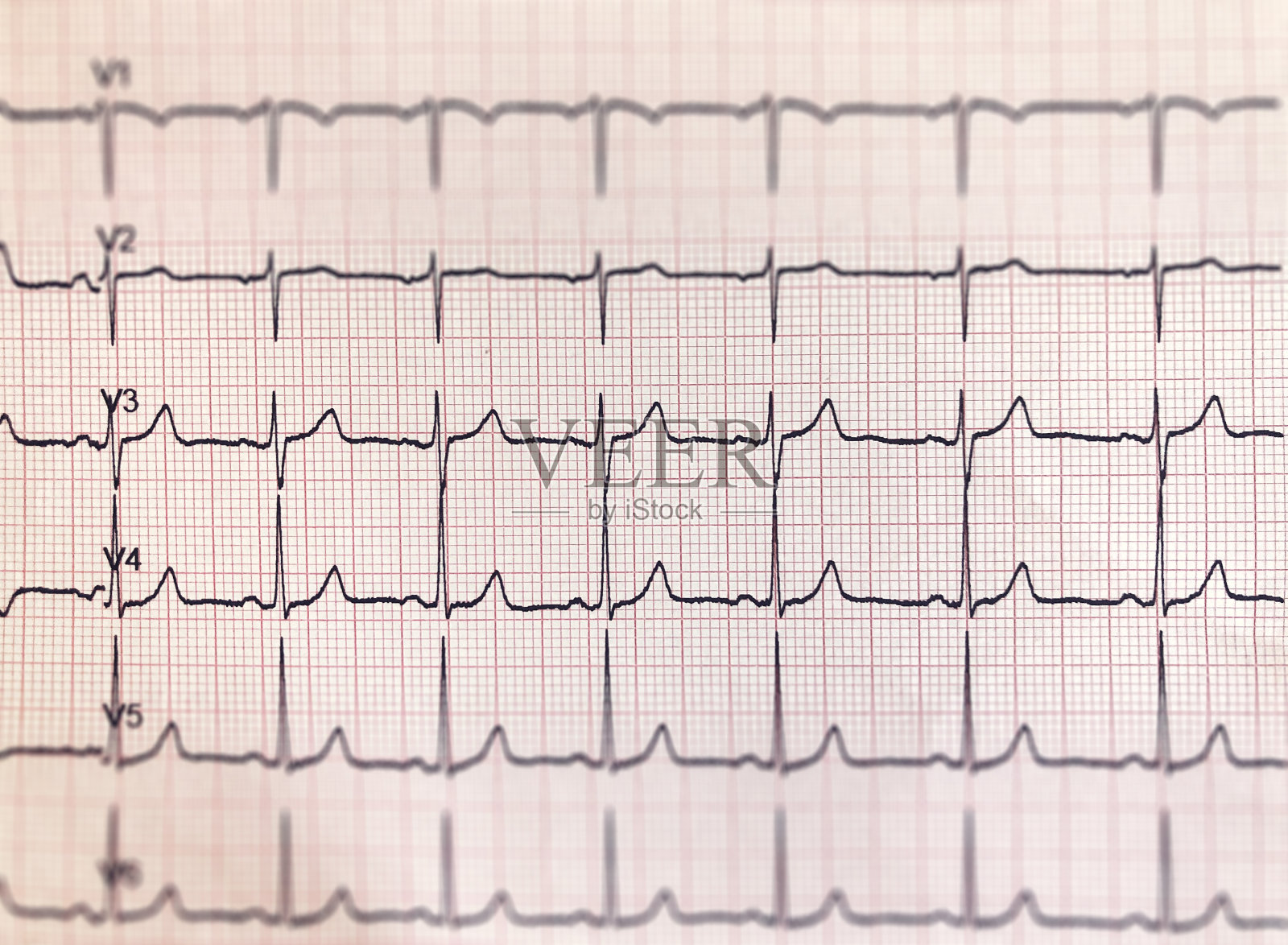 医院心电图检查照片摄影图片