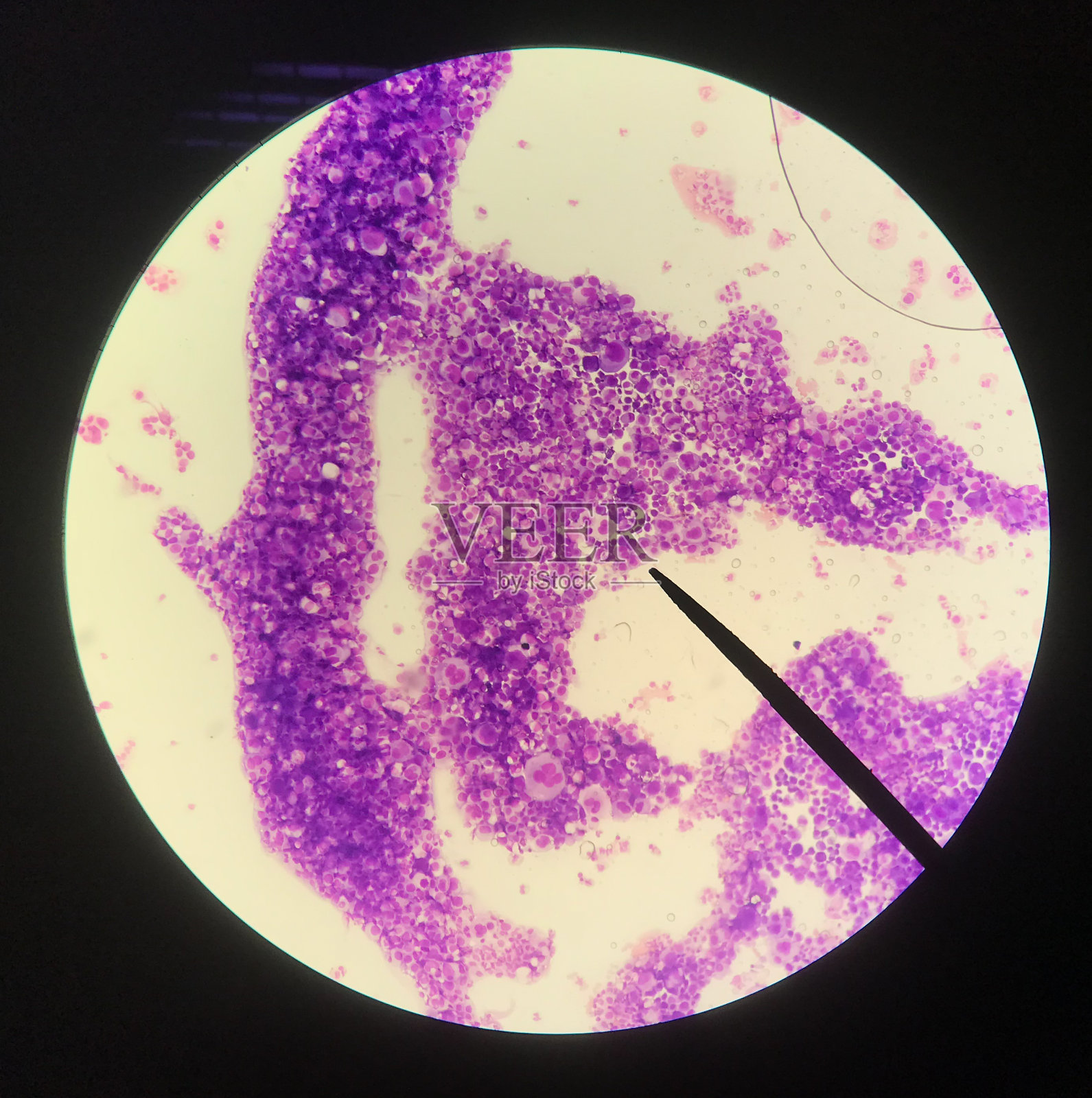 血液涂片的科学概念。照片摄影图片