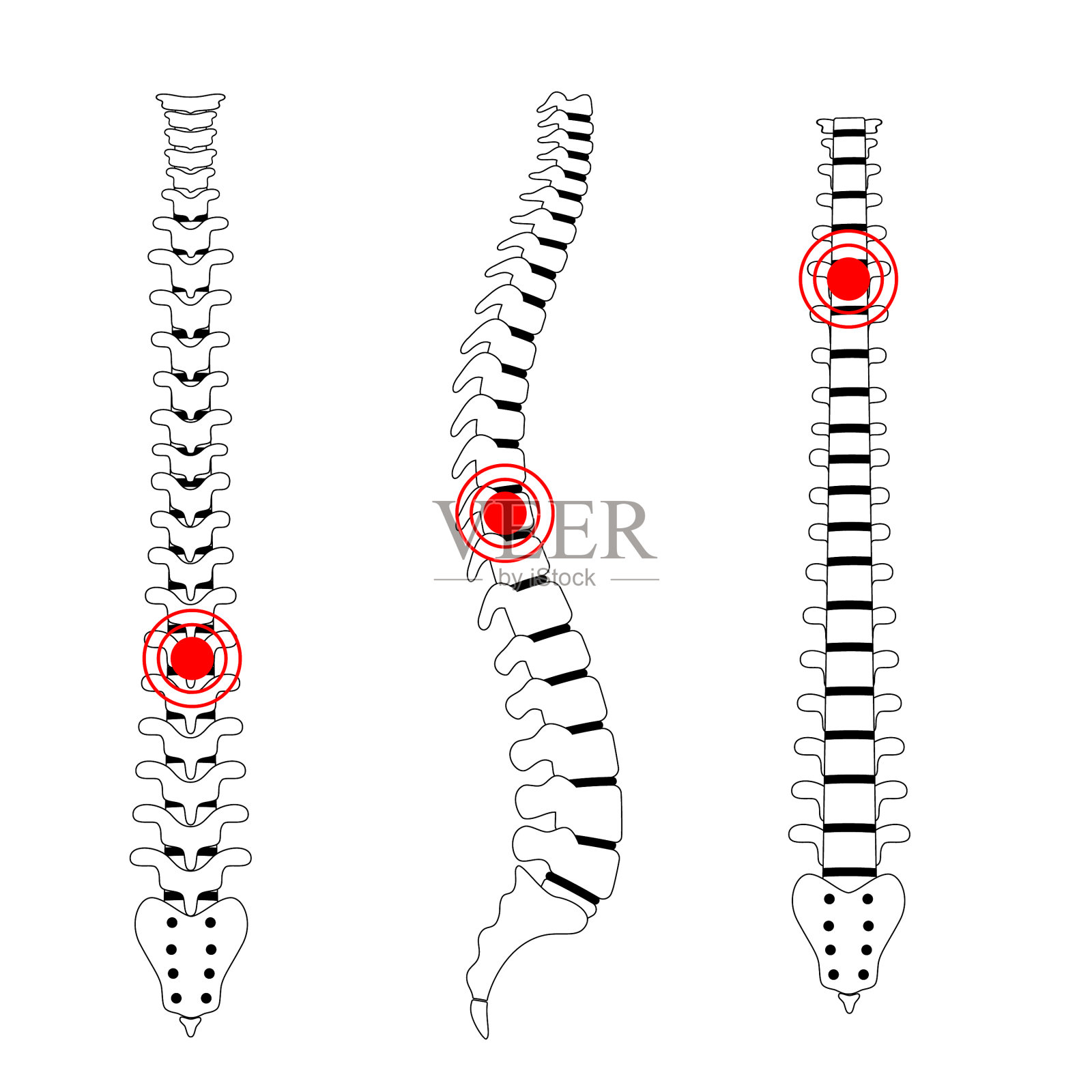 人类脊柱疼痛插画图片素材