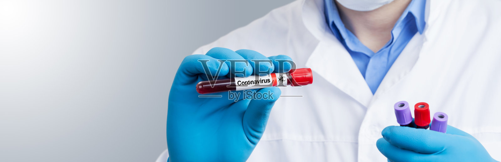 冠状病毒2019-nCoV血液样本。照片摄影图片