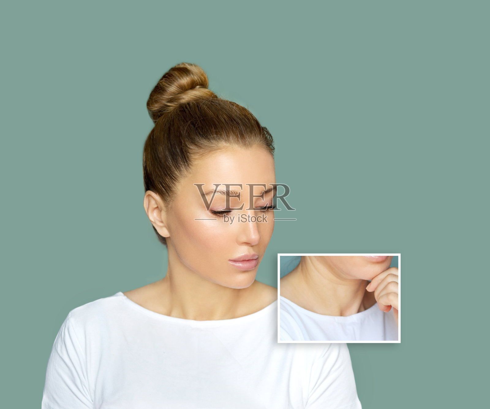 整形手术结果，颈部提升，颈阔肌成形术照片摄影图片