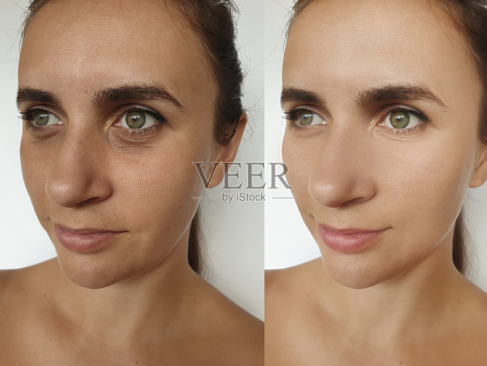 女人脸部皱纹治疗前后拼贴照片摄影图片