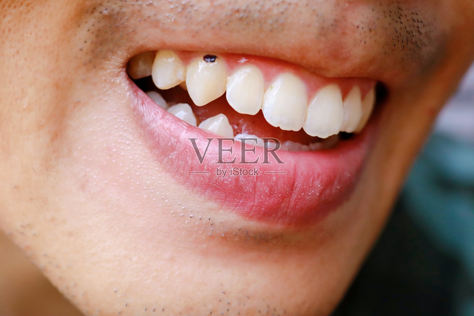 牙齿沾上巧克力照片摄影图片