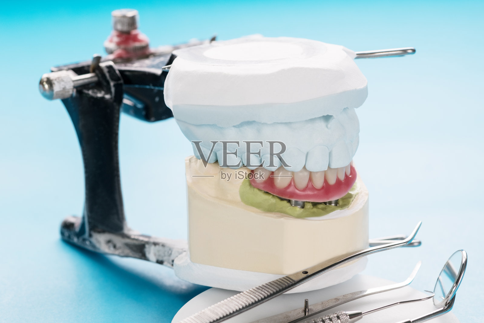 种植体支持覆盖义齿。照片摄影图片