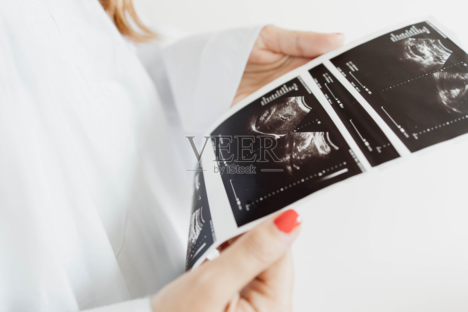 超声检查结果照片摄影图片