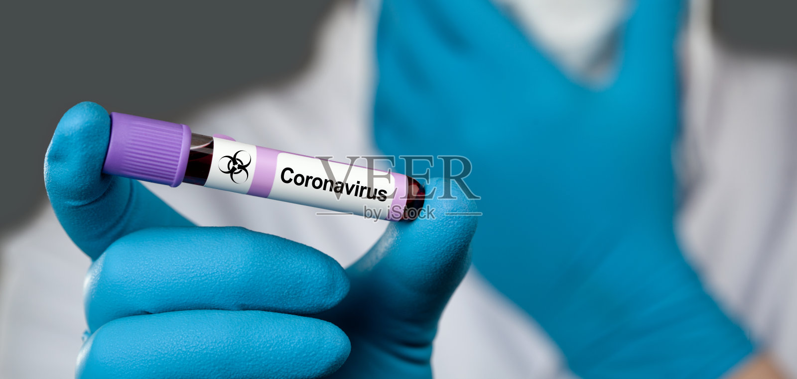 冠状病毒2019-nCoV血液样本。照片摄影图片