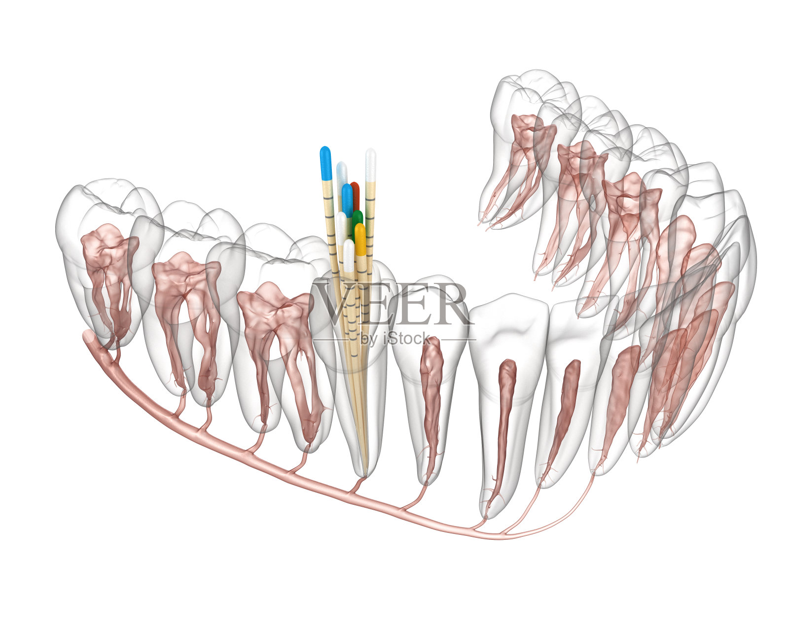 根管治疗过程。医学上准确的牙齿3D插图。照片摄影图片