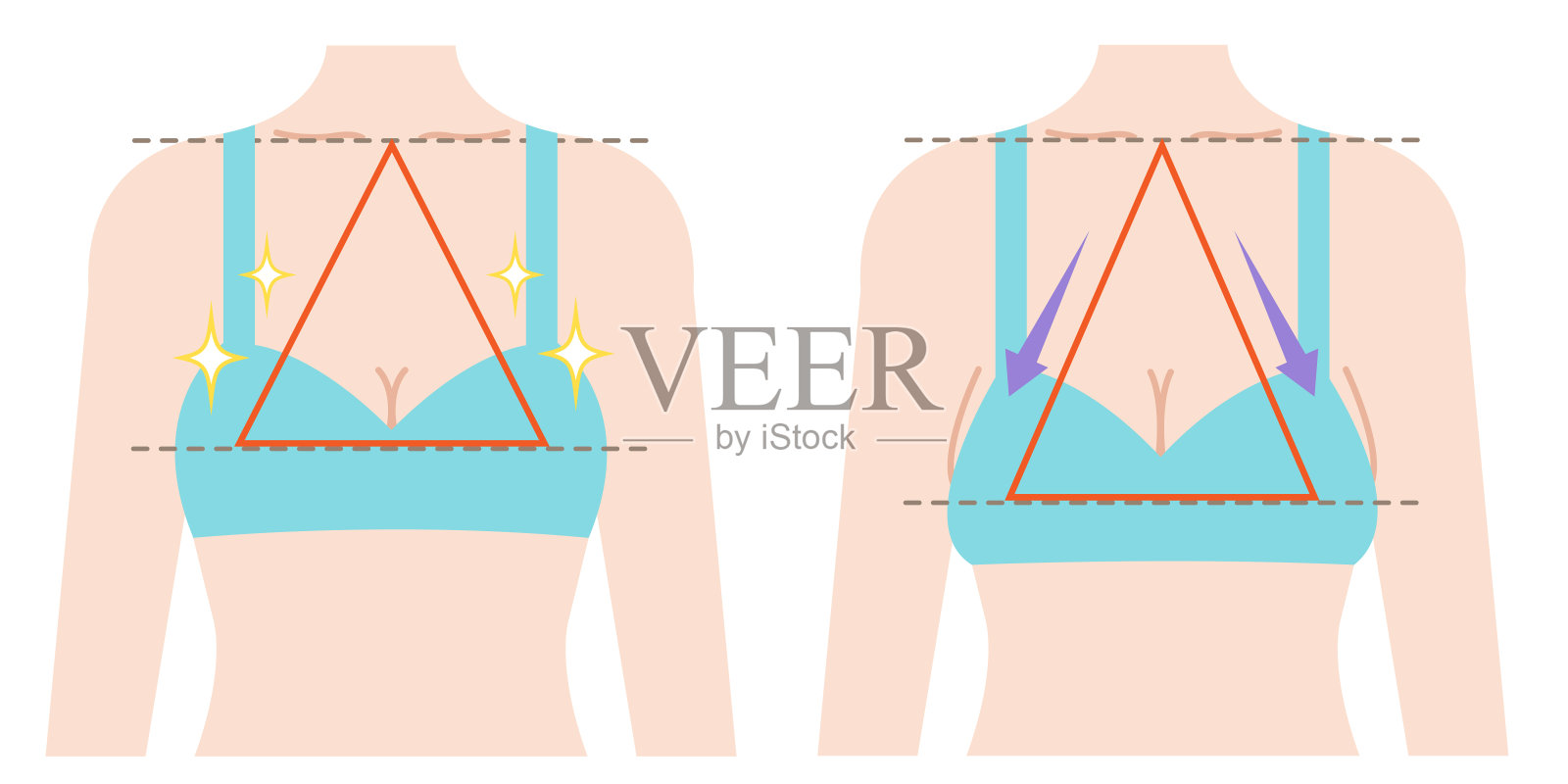 美丽的乳房和下垂的乳房。在白色背景上进行隔离插画图片素材