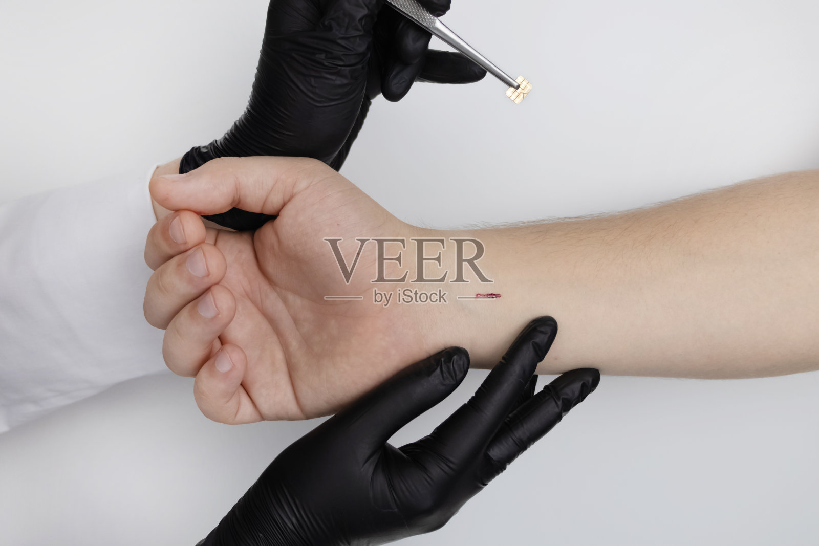 整形外科医生开了个小口把芯片插入病人的手臂。生物技术、电子文件和技术未来概念照片摄影图片