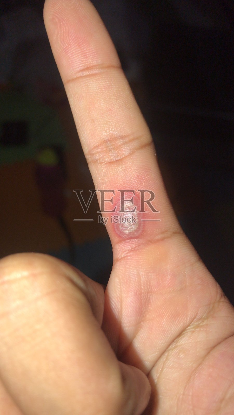 手指上的老茧照片摄影图片