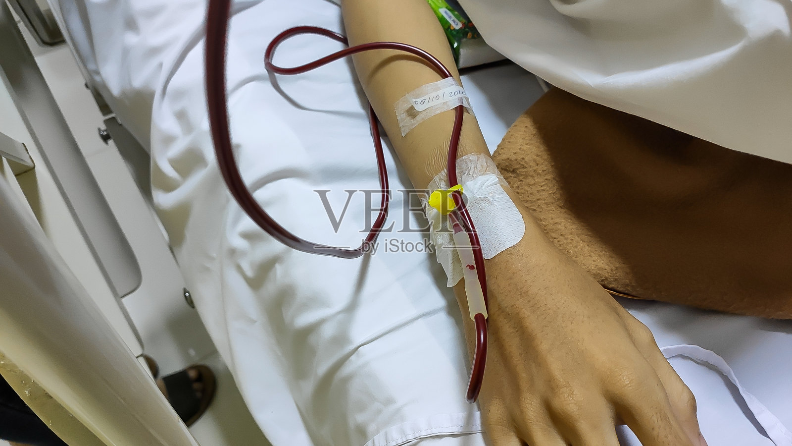 输血，把手收起来照片摄影图片