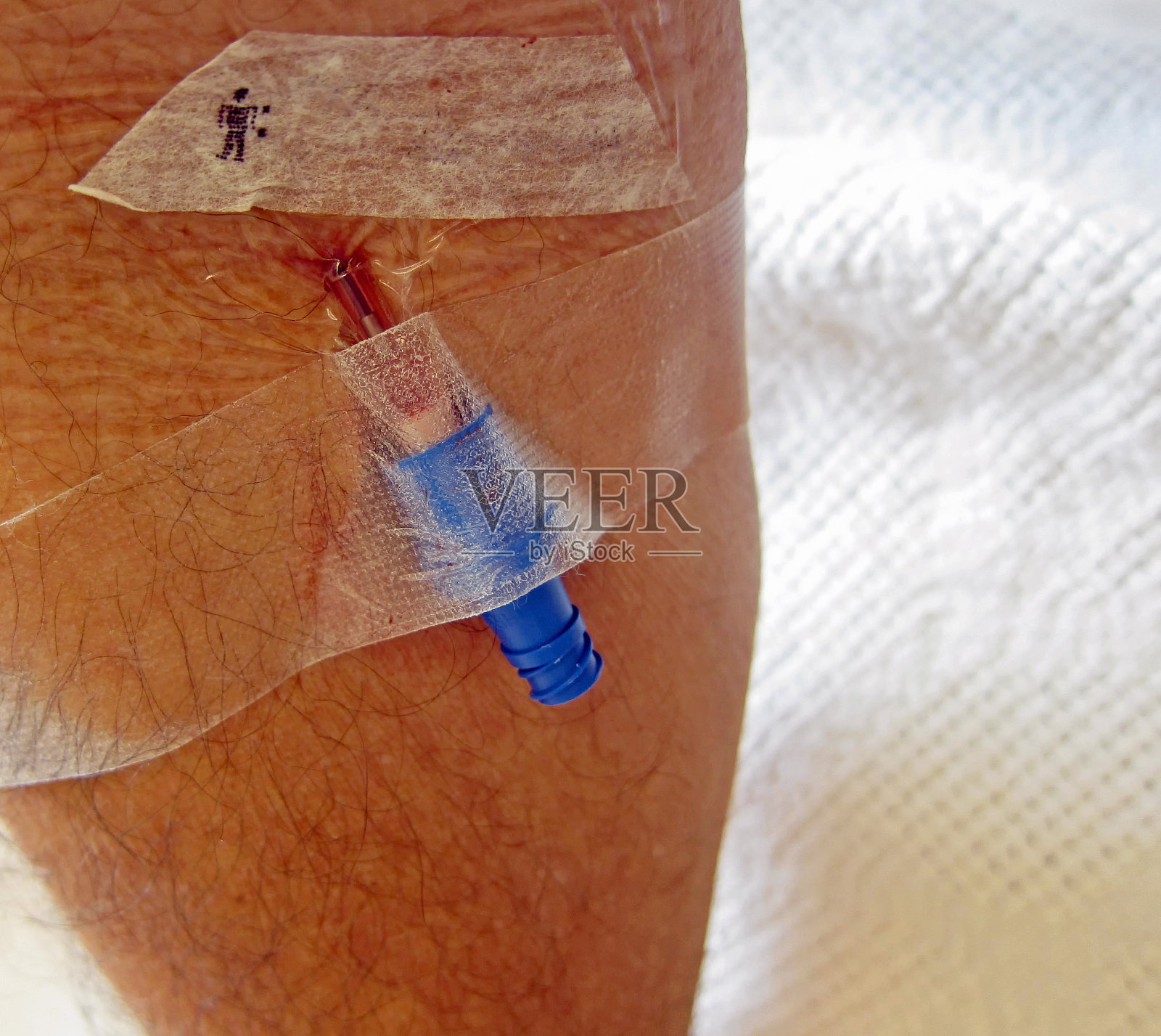 手臂针头照片摄影图片