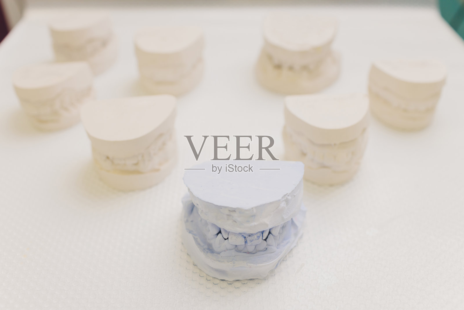 人类颌骨的牙科铸造石膏模型，牙齿不齐和远端咬合，正畸治疗前拍摄灰色背景技术照照片摄影图片