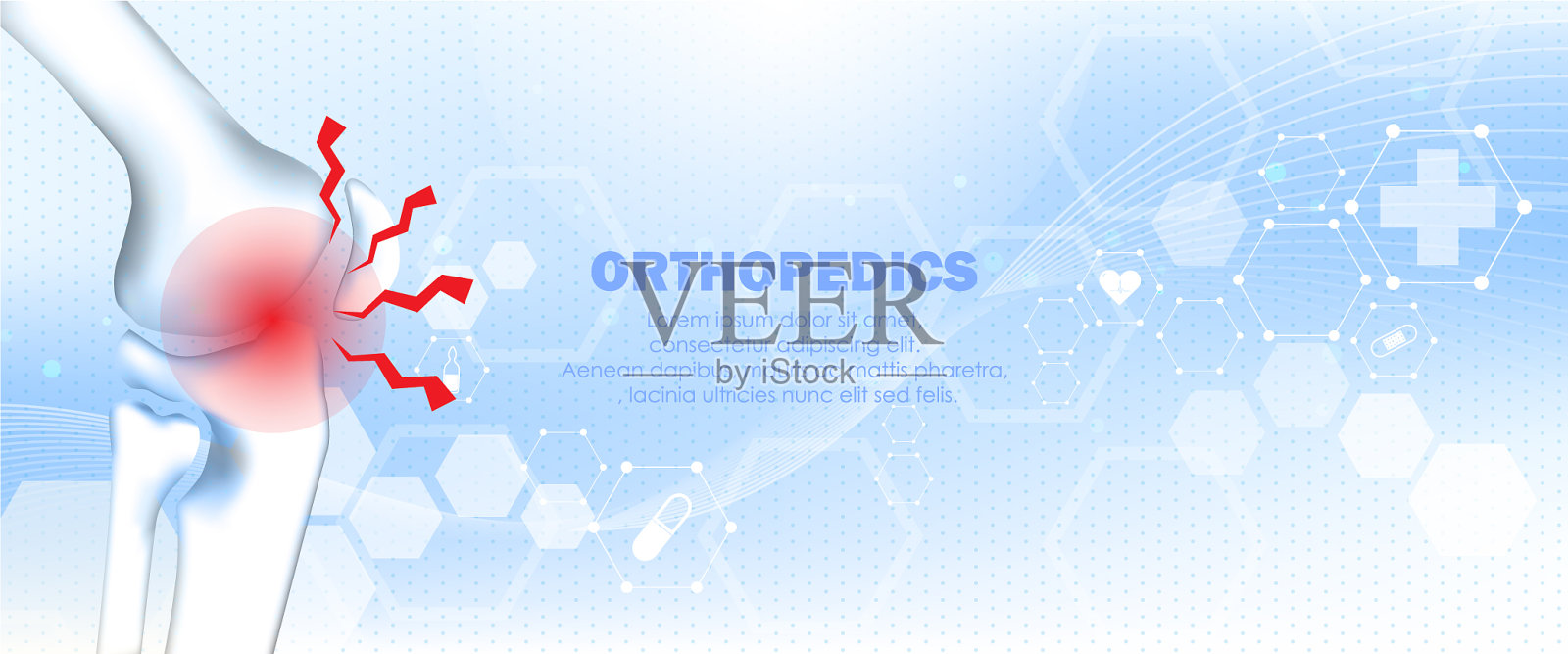 医用骨科膝骨损伤插画图片素材