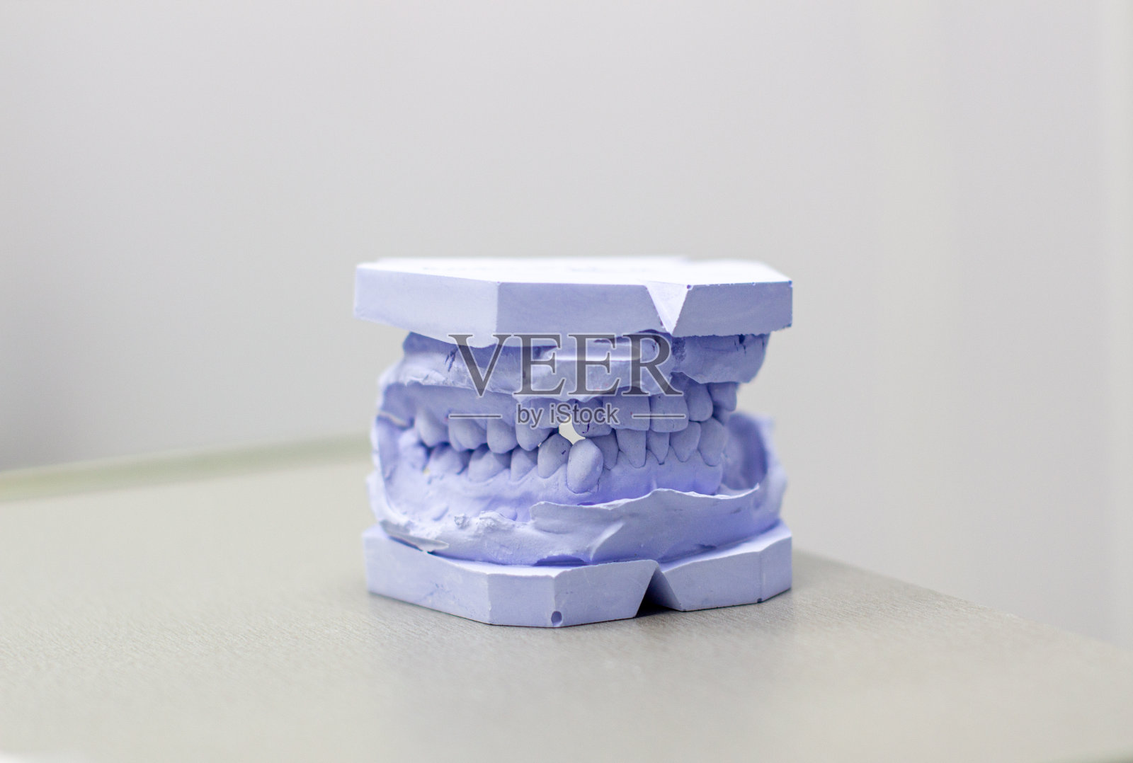 牙齿石膏模型（正畸牙医处）照片摄影图片