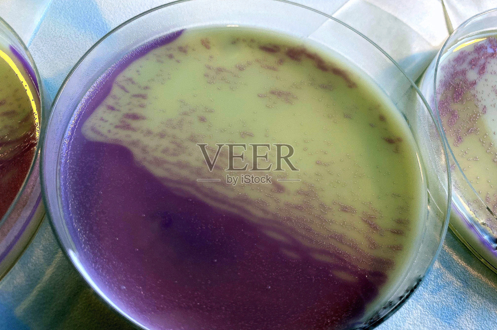 在显色琼脂上培养万古霉素耐药肠球菌(VRE)。粉色的蜂群是VRE。照片摄影图片