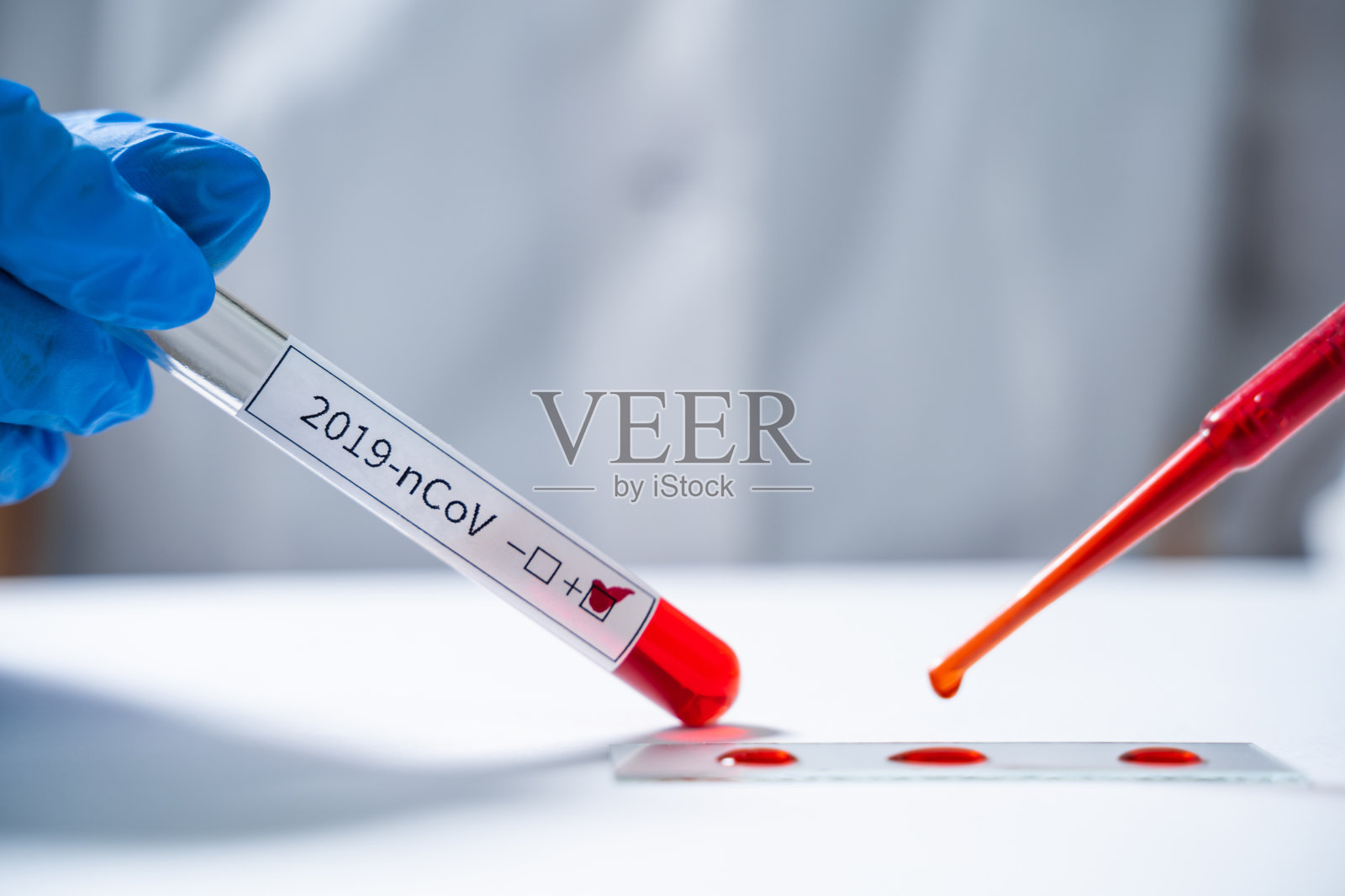 实验室助理检测来自的新型冠状病毒血液照片摄影图片