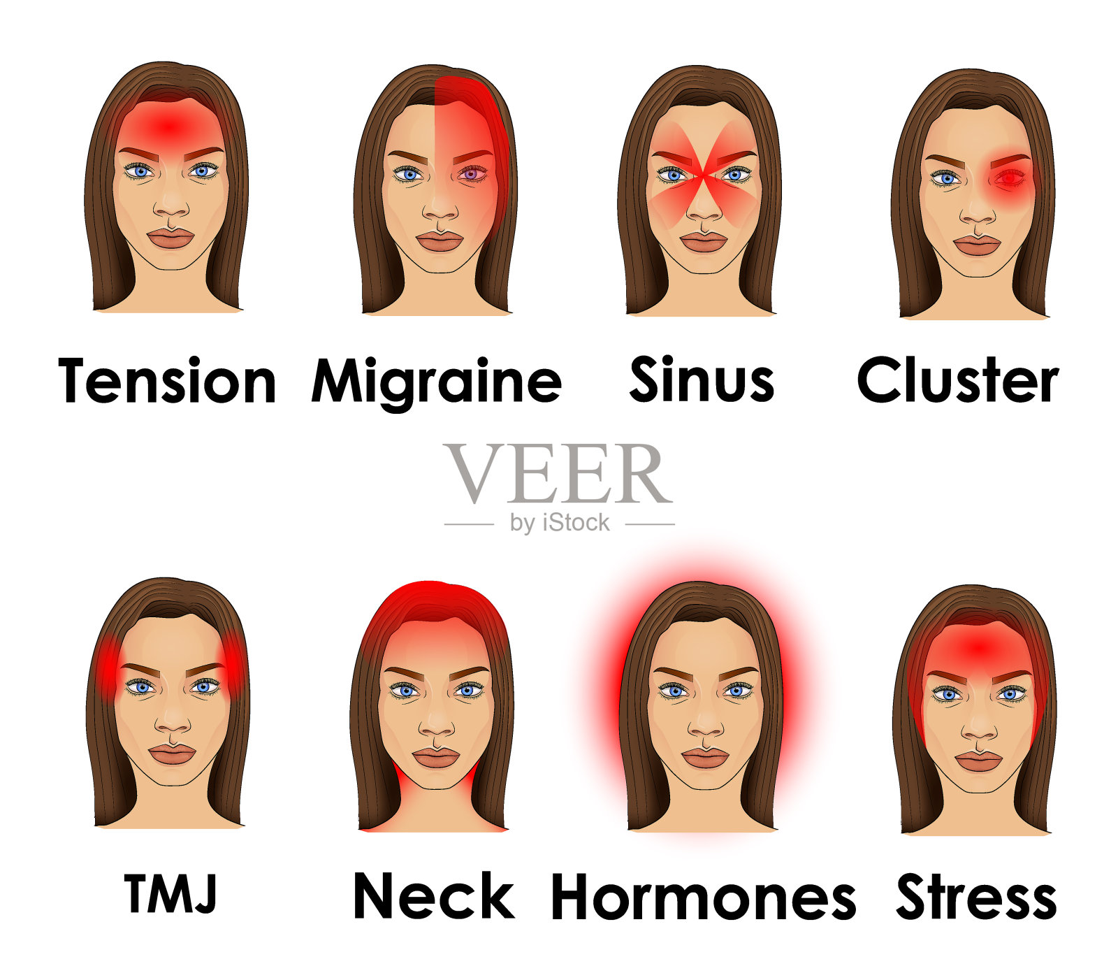 女人脸上的头痛类型插画图片素材