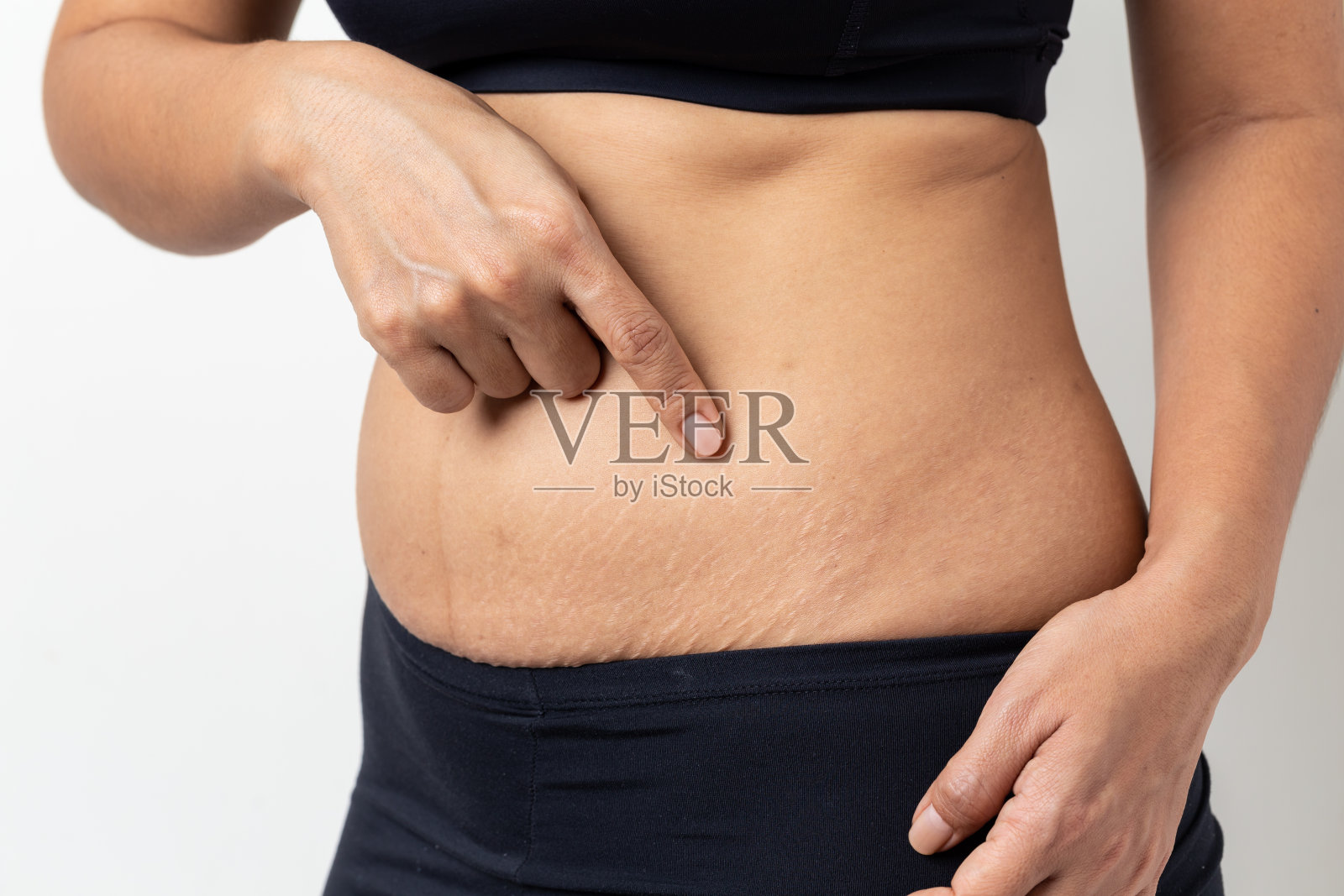 妊娠纹，女性在白色背景下展示产后的腹部照片摄影图片