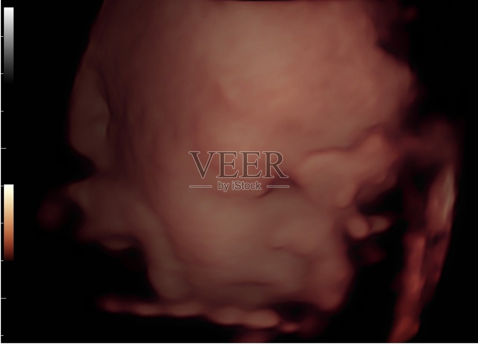 3D 4D胎儿超声图像(孕妇20周三维胎儿)照片摄影图片