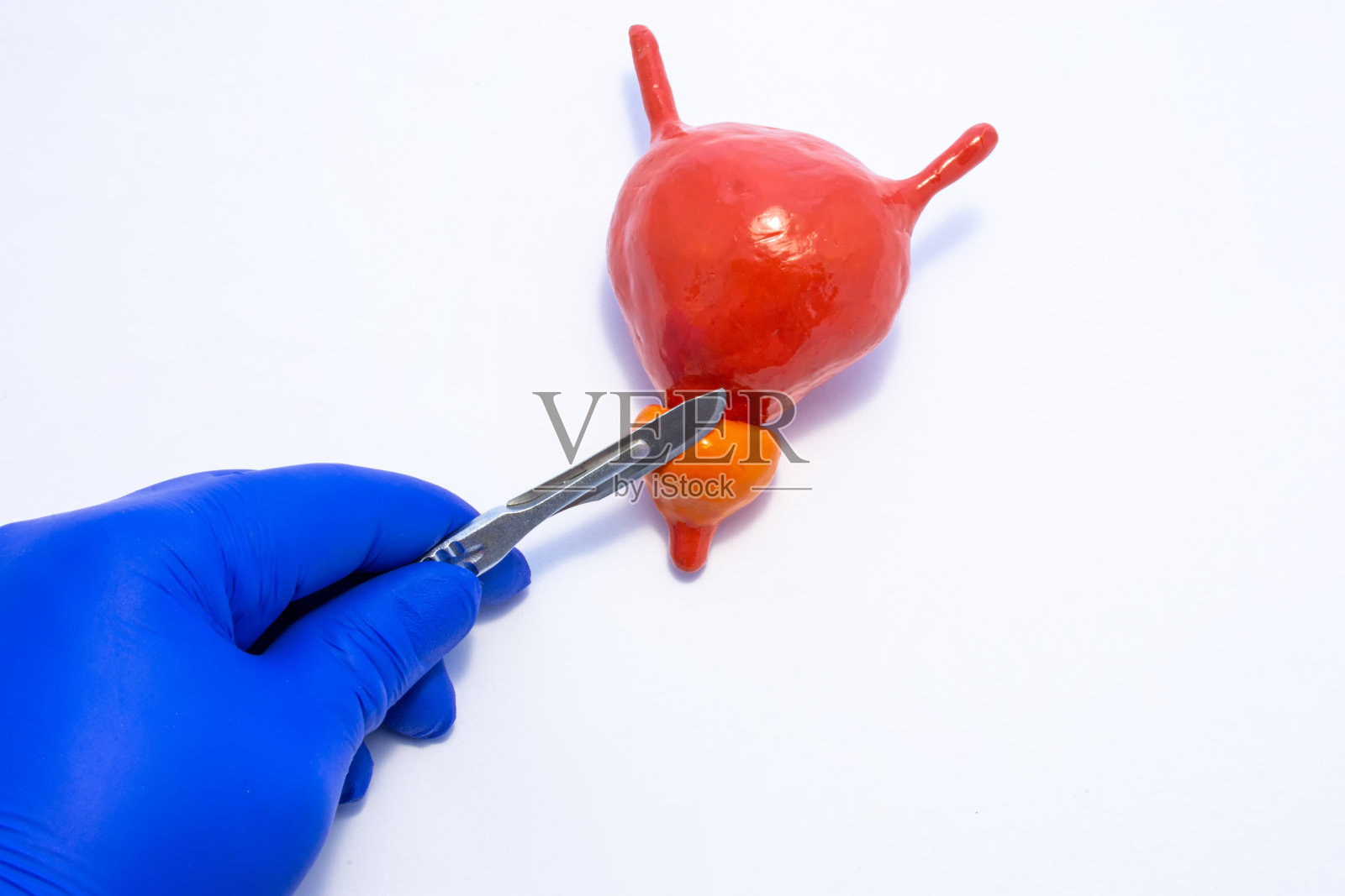 泌尿外科医生手里拿着一把手术刀放在膀胱和前列腺的解剖模型上。男性生殖器和泌尿器官手术治疗的概念照片照片摄影图片