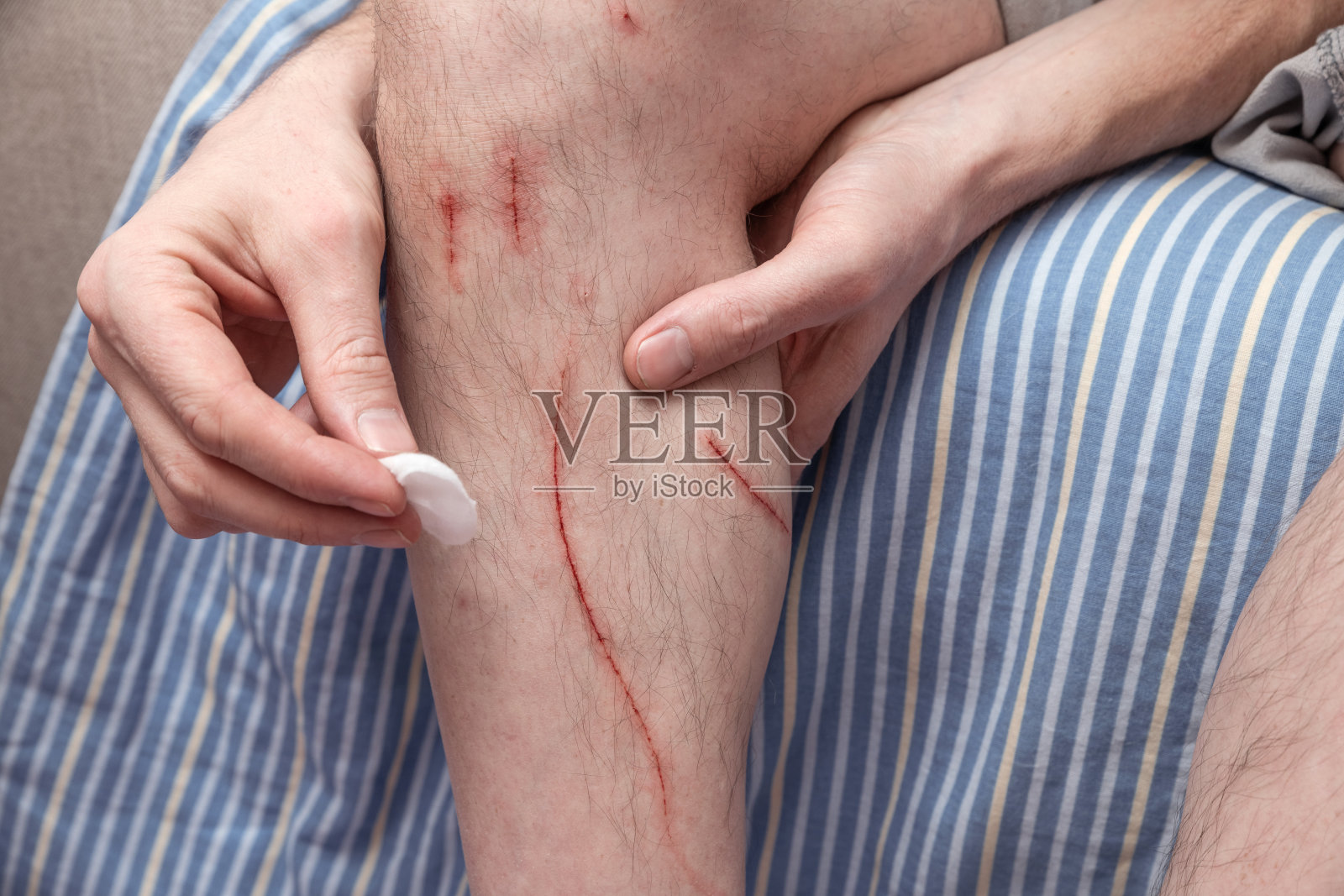 男人用消毒棉签处理他的沙利宾。照片摄影图片