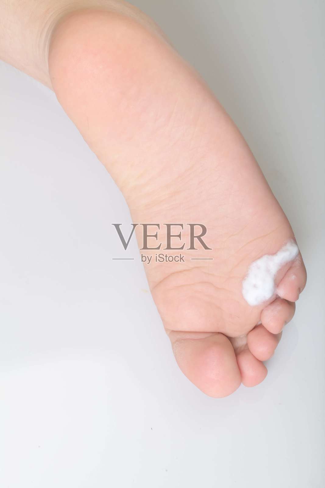 孩子的脚底伤口用泡沫治疗照片摄影图片