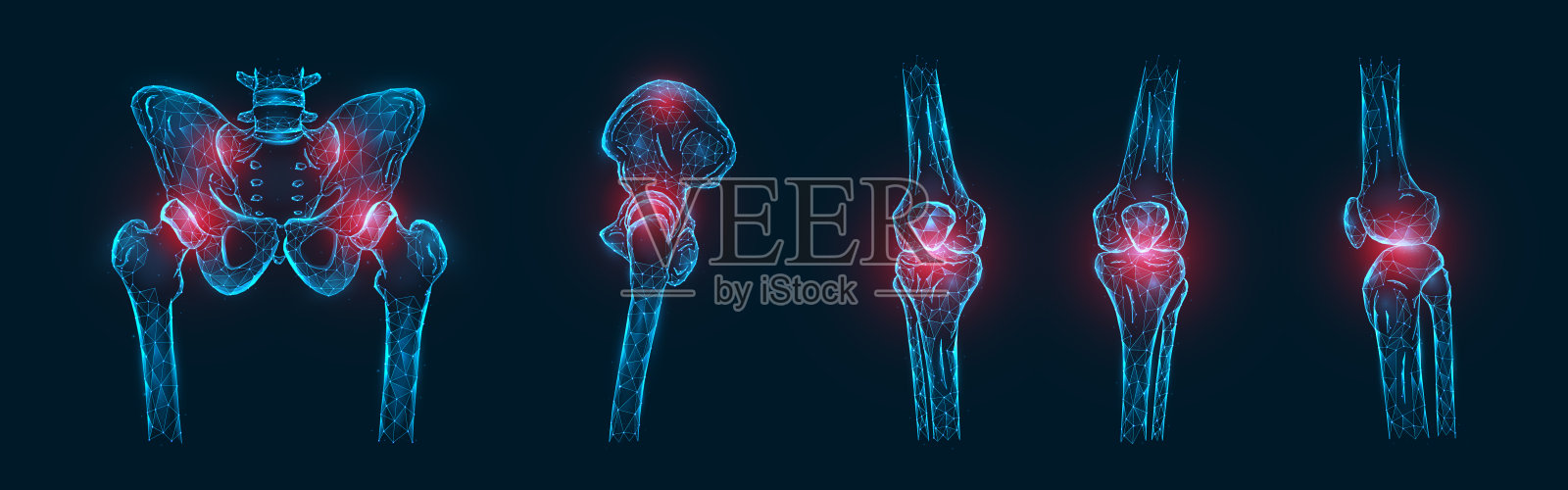 多边形矢量图解的疼痛或炎症的骨头在骨盆，髋关节，膝关节孤立。关节疼痛的概念插画图片素材