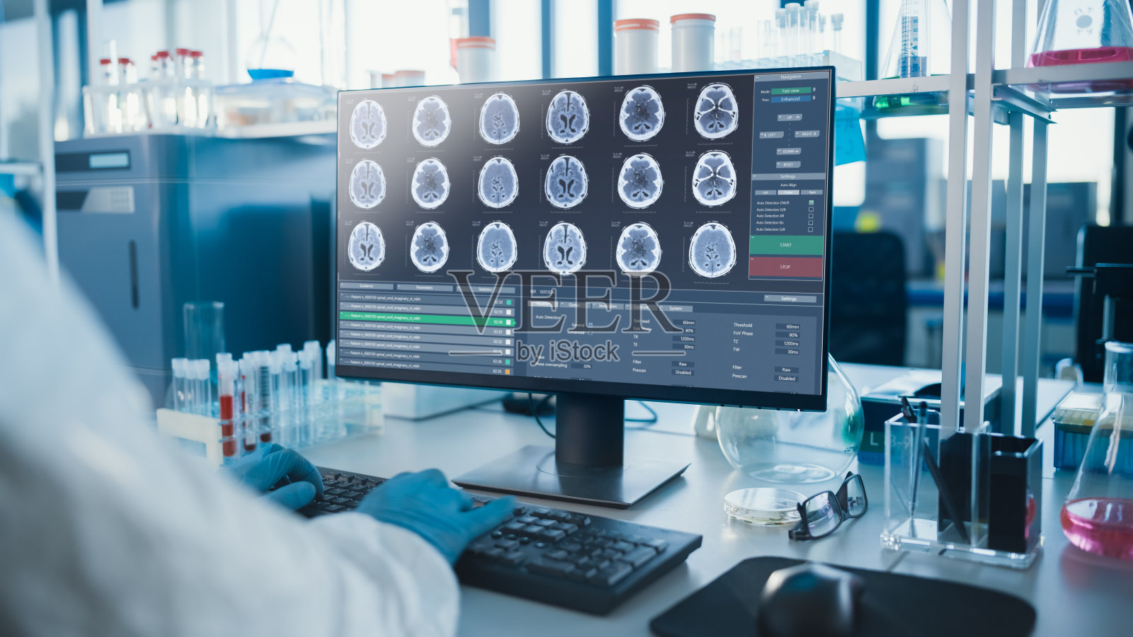 高级大脑研究实验室:神经学科学家正在使用个人电脑显示MRI, CT扫描与大脑图像。现代实验室研究大脑，开发疫苗，药物。照片摄影图片