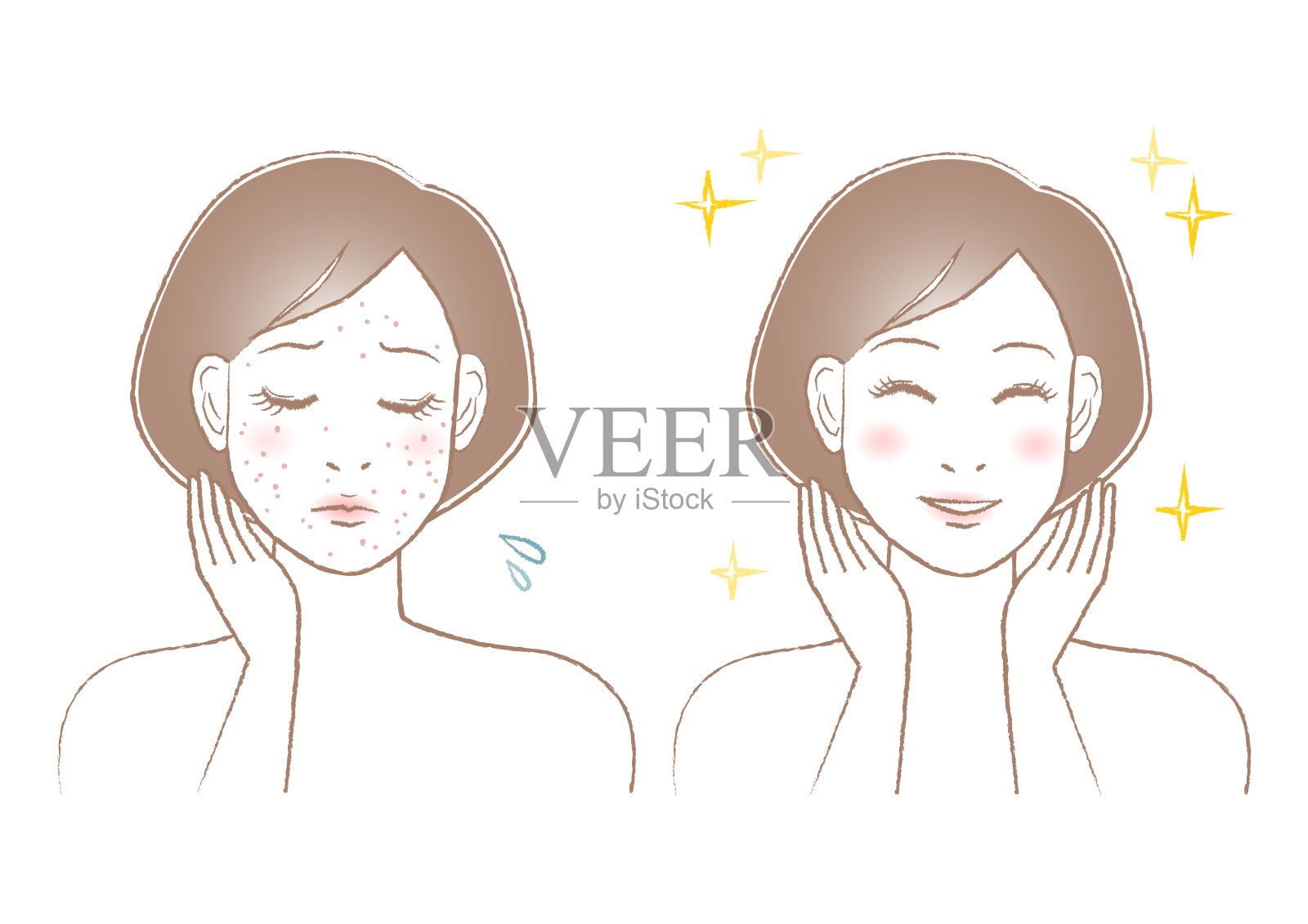 女人的美丽插图。痘痘、斑点和雀斑的烦恼。白色背景。矢量插图。插画图片素材