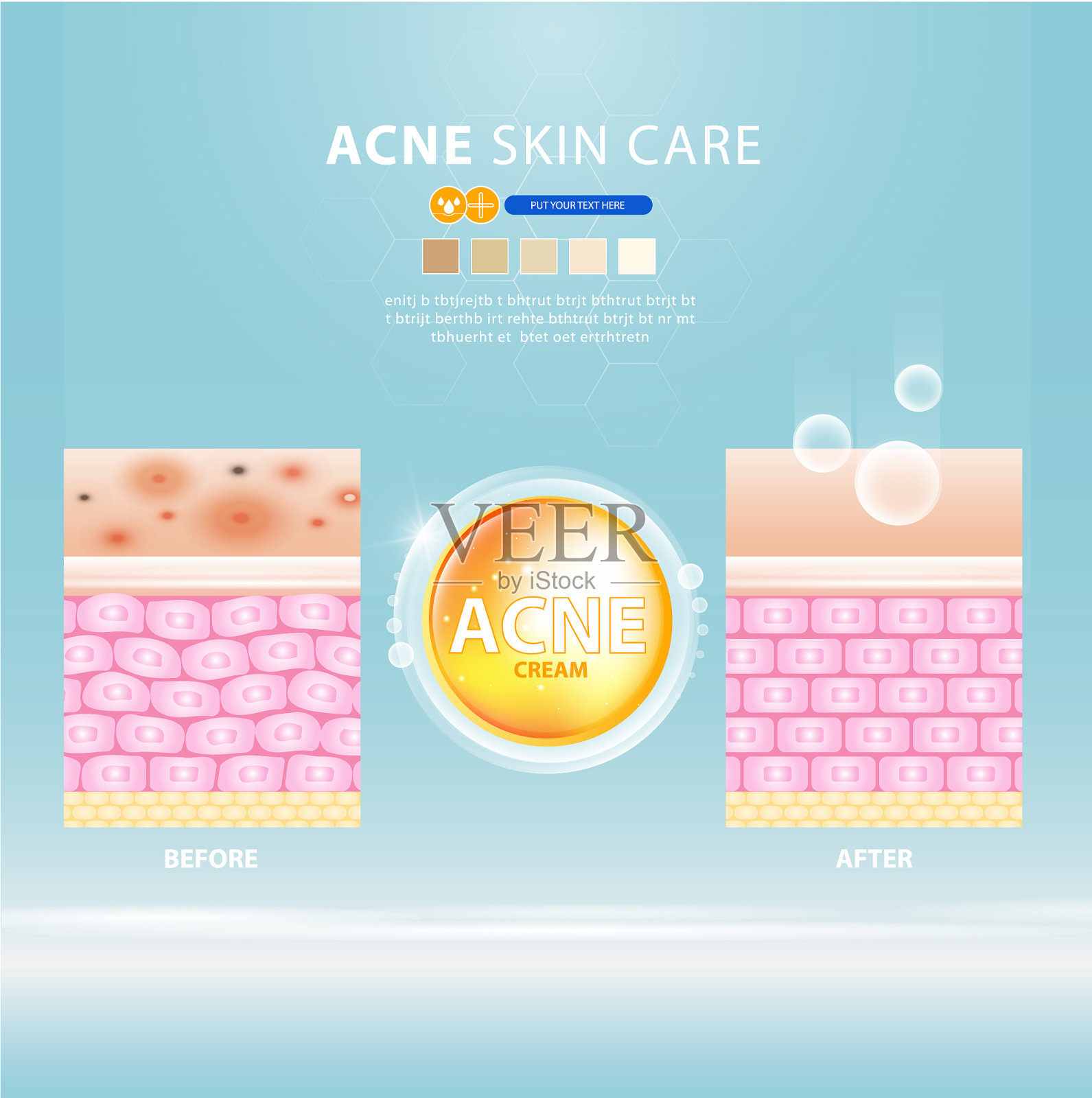 痘痘皮肤痘痘问题设计插画图片素材