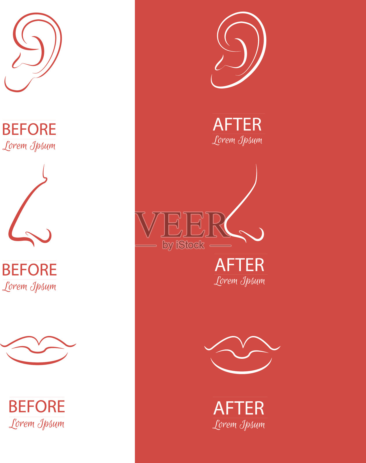 耳朵，鼻子和嘴唇整形前后插画图片素材