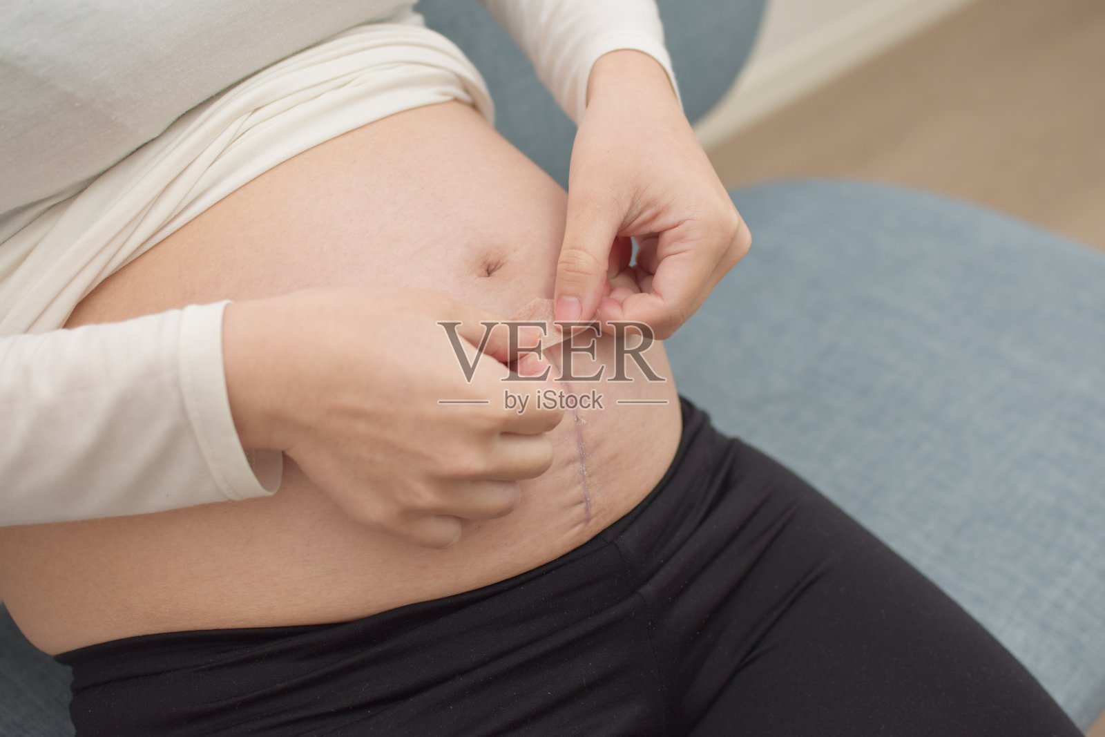 年轻孕妇用胶带包扎手术疤痕照片摄影图片