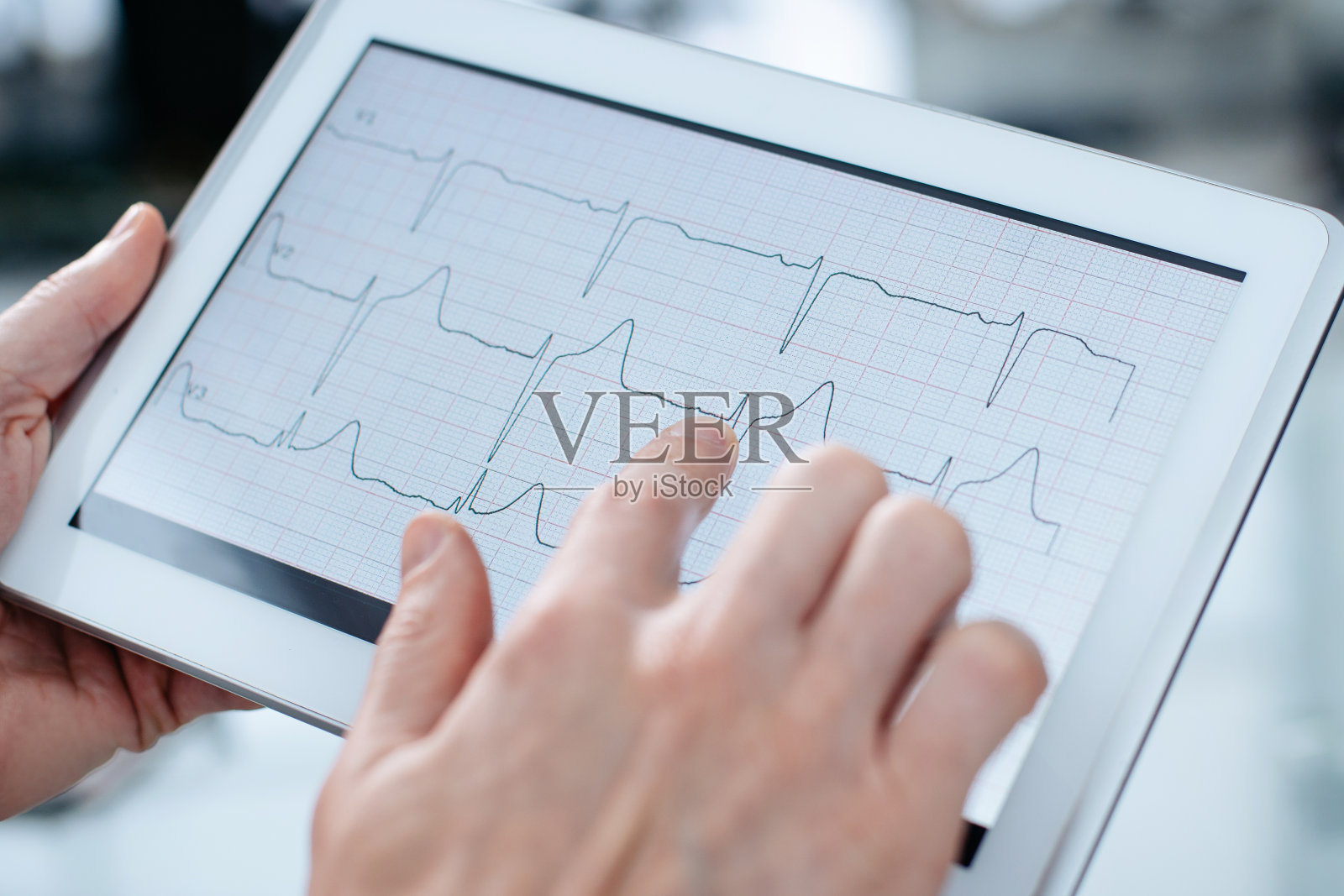 医生在电脑屏幕上看心电图照片摄影图片