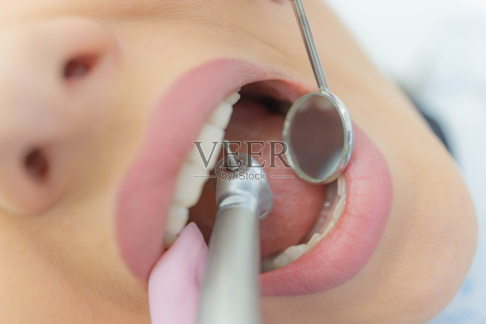 正在牙医那里检查牙齿的女人照片摄影图片