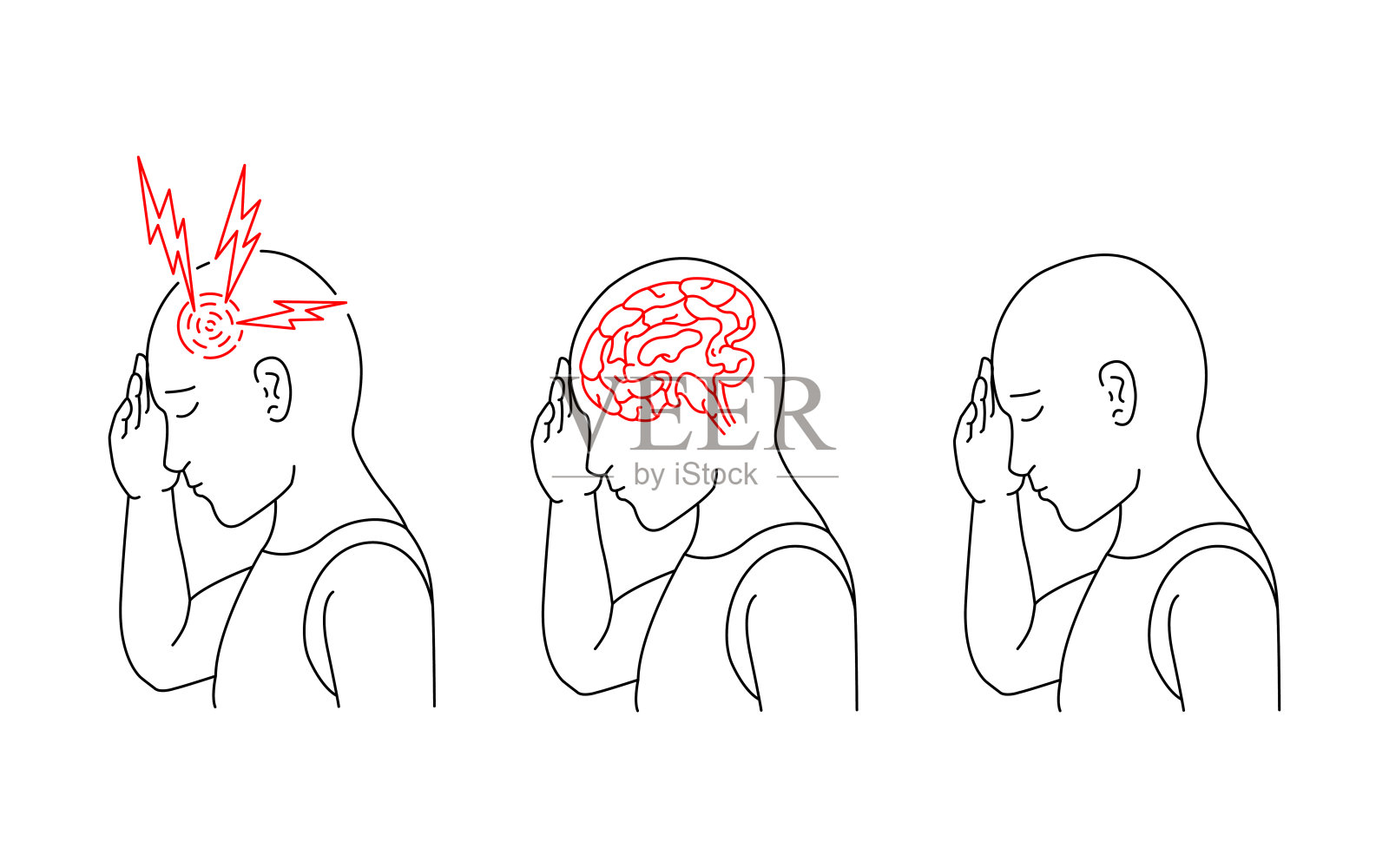 矢量插图的人经历头痛和人类大脑的炎症。插画图片素材