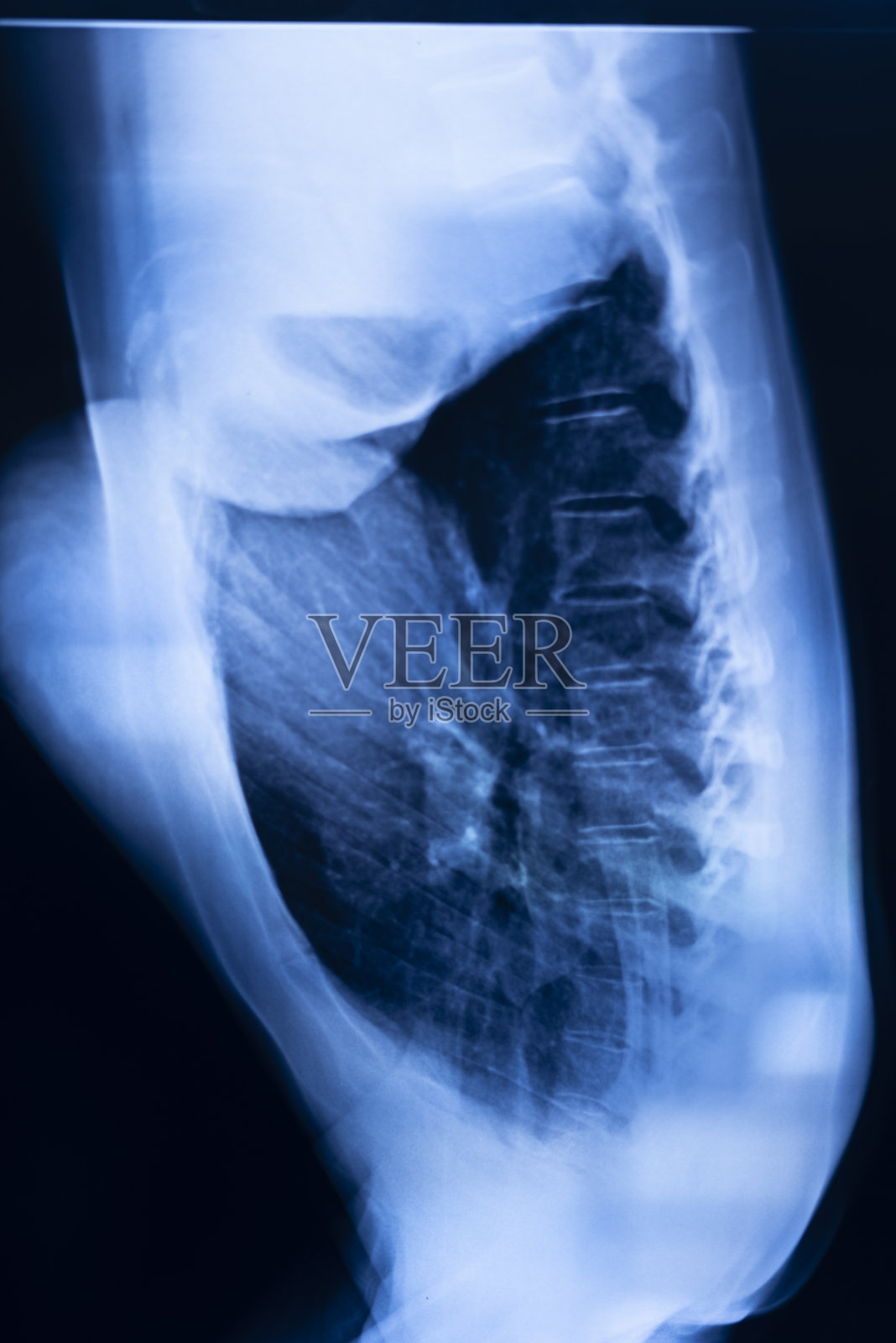 肺肋骨x线扫描结果。照片摄影图片