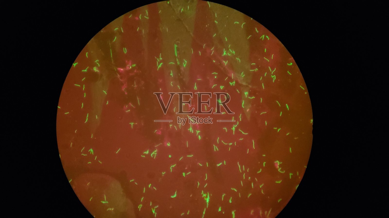 免疫氟化螺旋藻的免疫荧光照片摄影图片