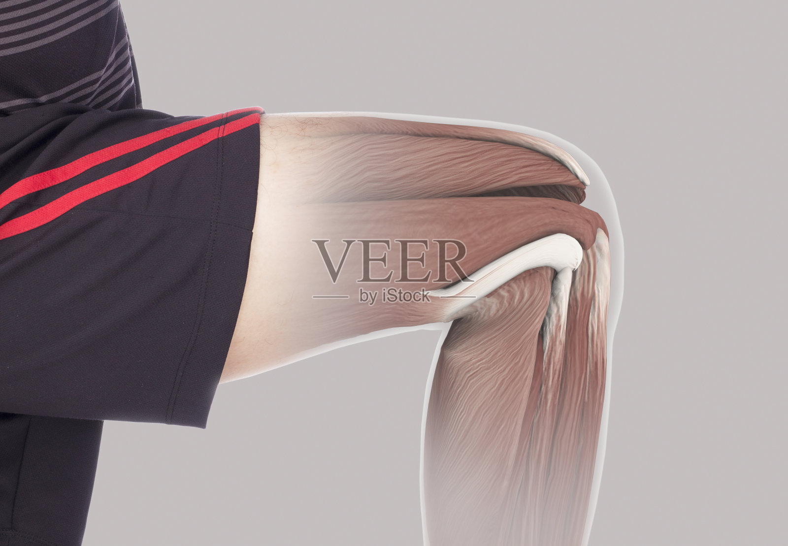 x射线肌肉拉伤照片摄影图片