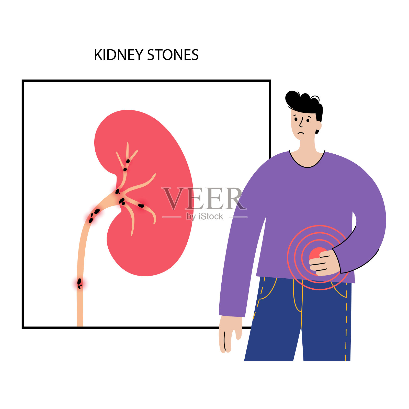 肾脏疾病的概念插画图片素材