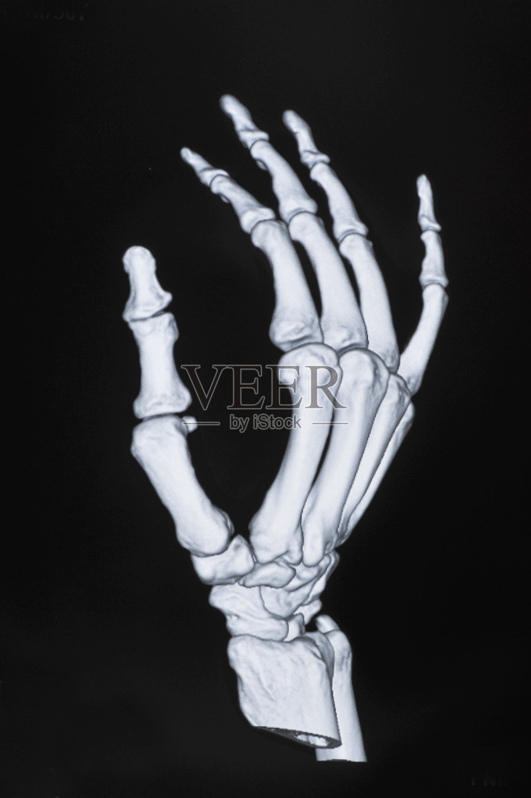 x射线的手照片摄影图片