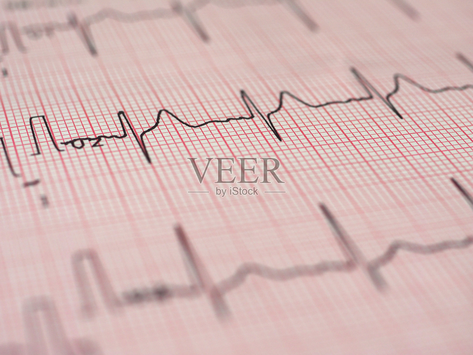 心脏跳动的心电图照片摄影图片