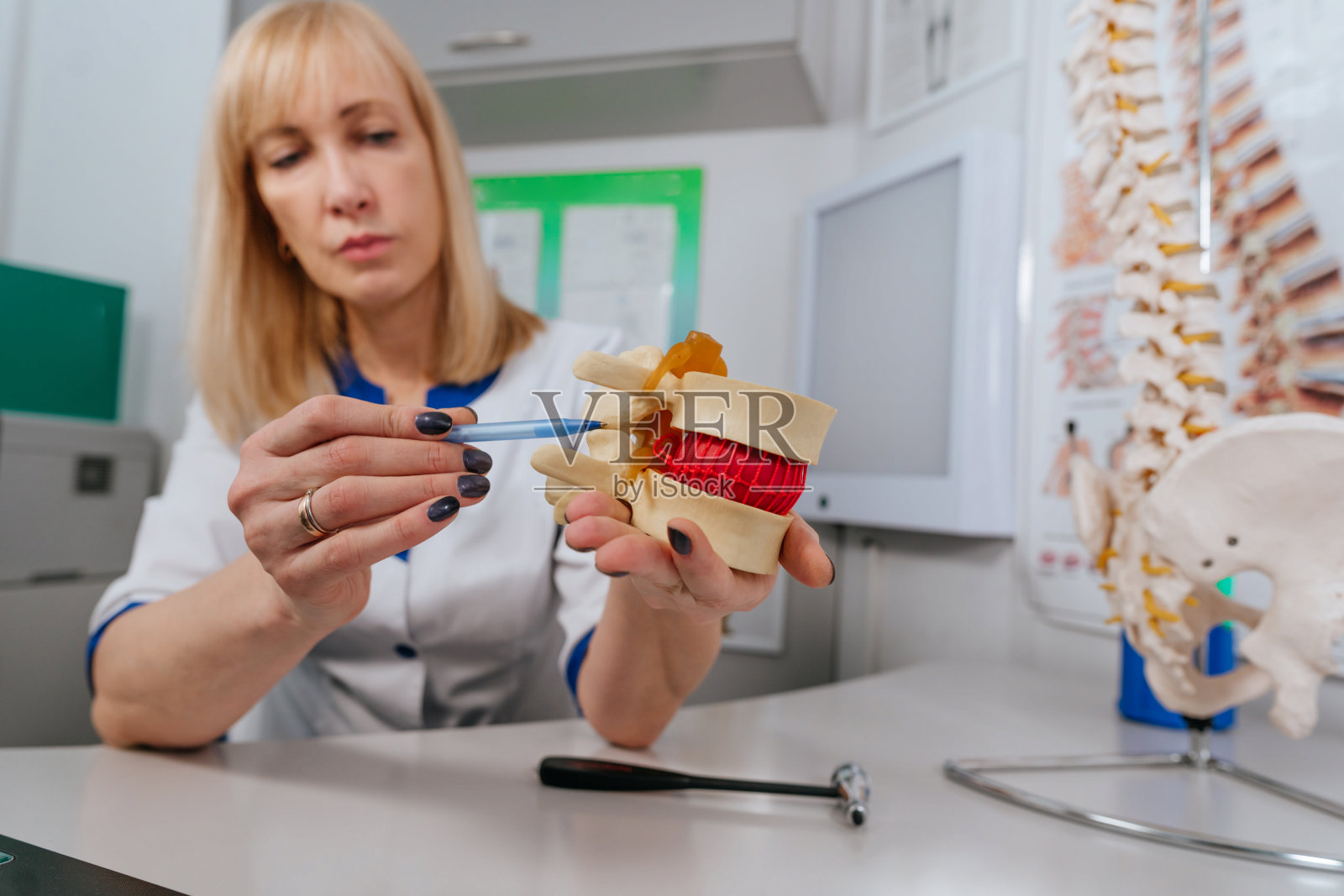 理疗医师使用脊柱模型解释损伤机制照片摄影图片