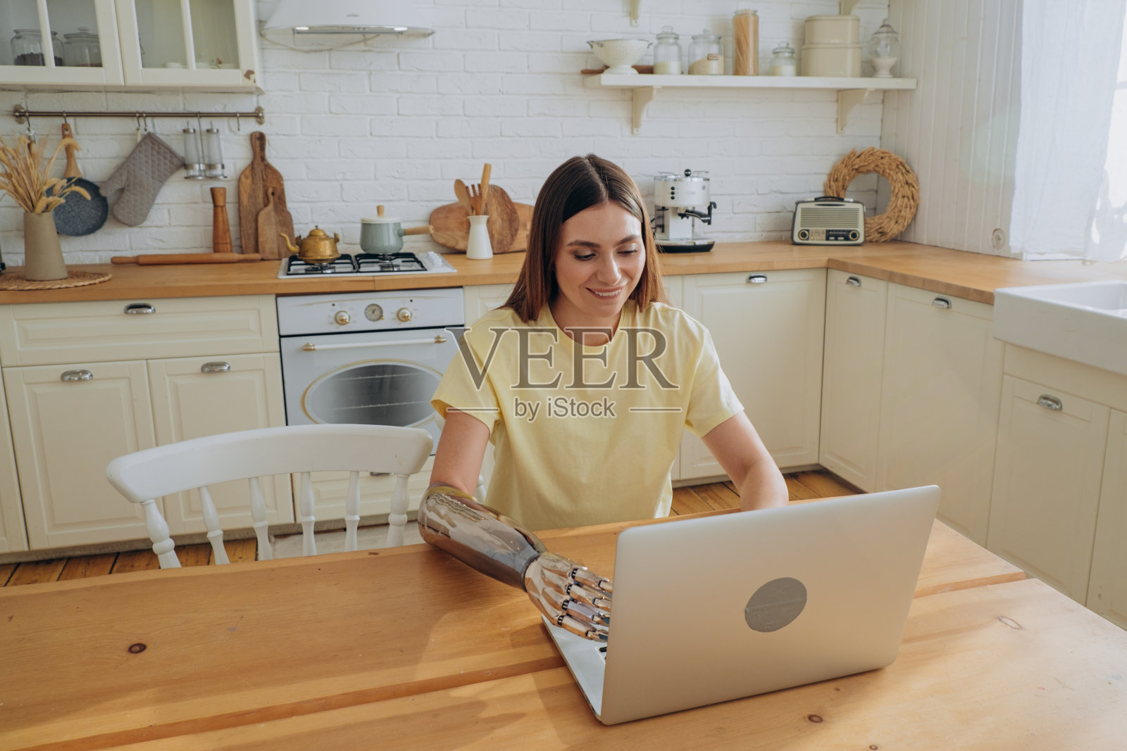 年轻女子用仿生手臂在笔记本电脑上上网照片摄影图片
