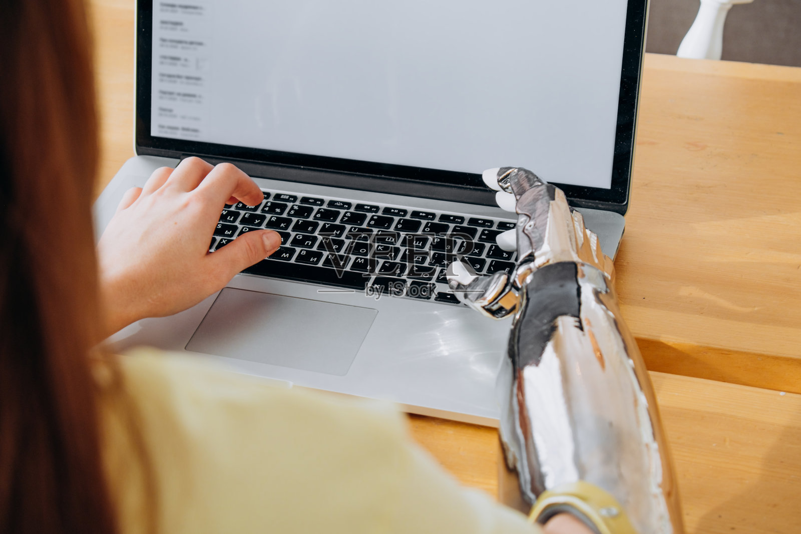 一名女子用金属仿生手臂在笔记本电脑键盘上打字照片摄影图片