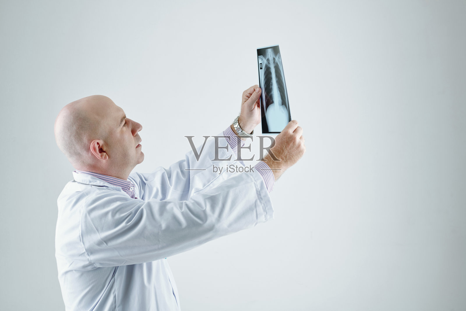 秃顶放射学家在光线下观察x射线图像照片摄影图片