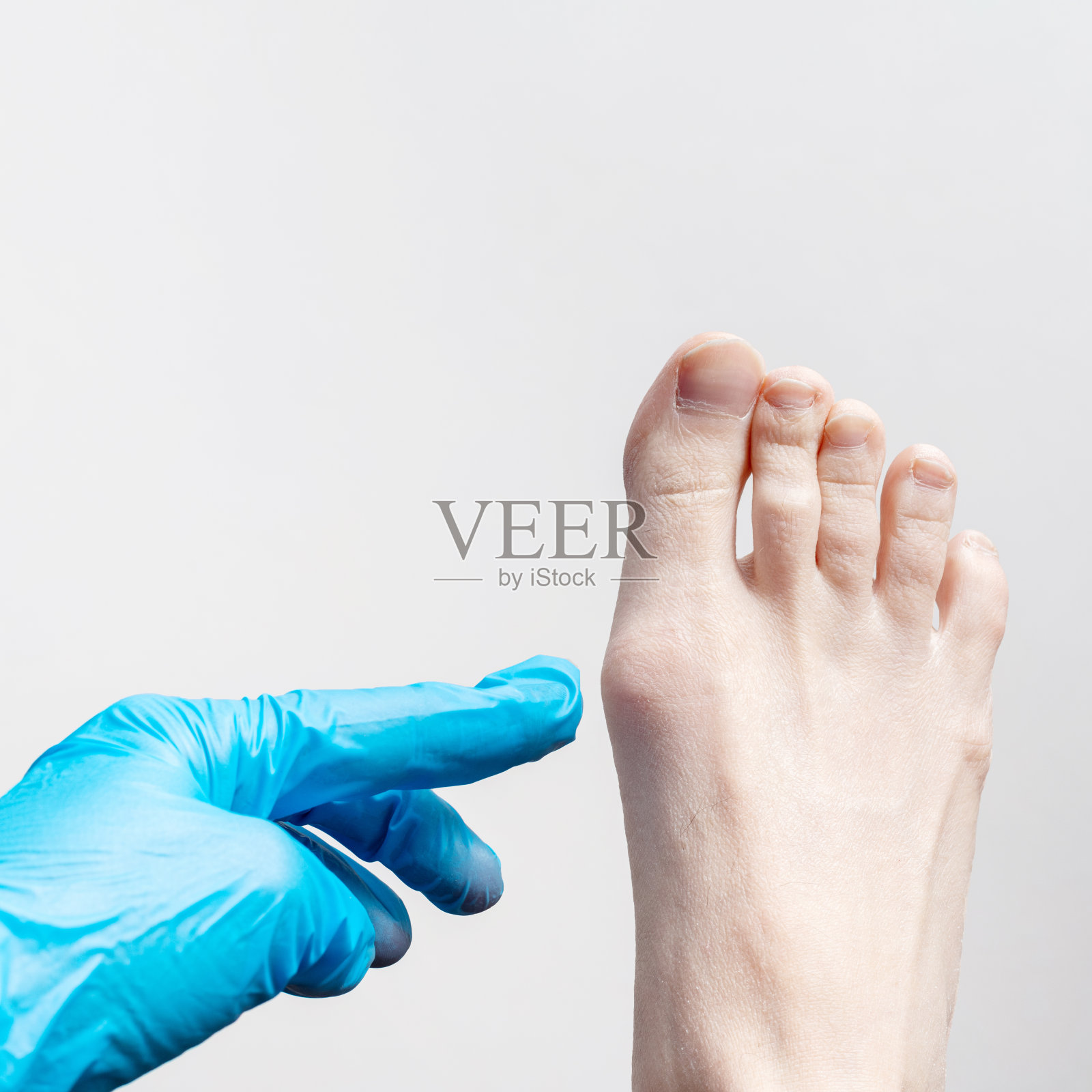 手拿蓝色医用手套，骨科医生正在检查一位女士的腿、脚筛检试验照片摄影图片
