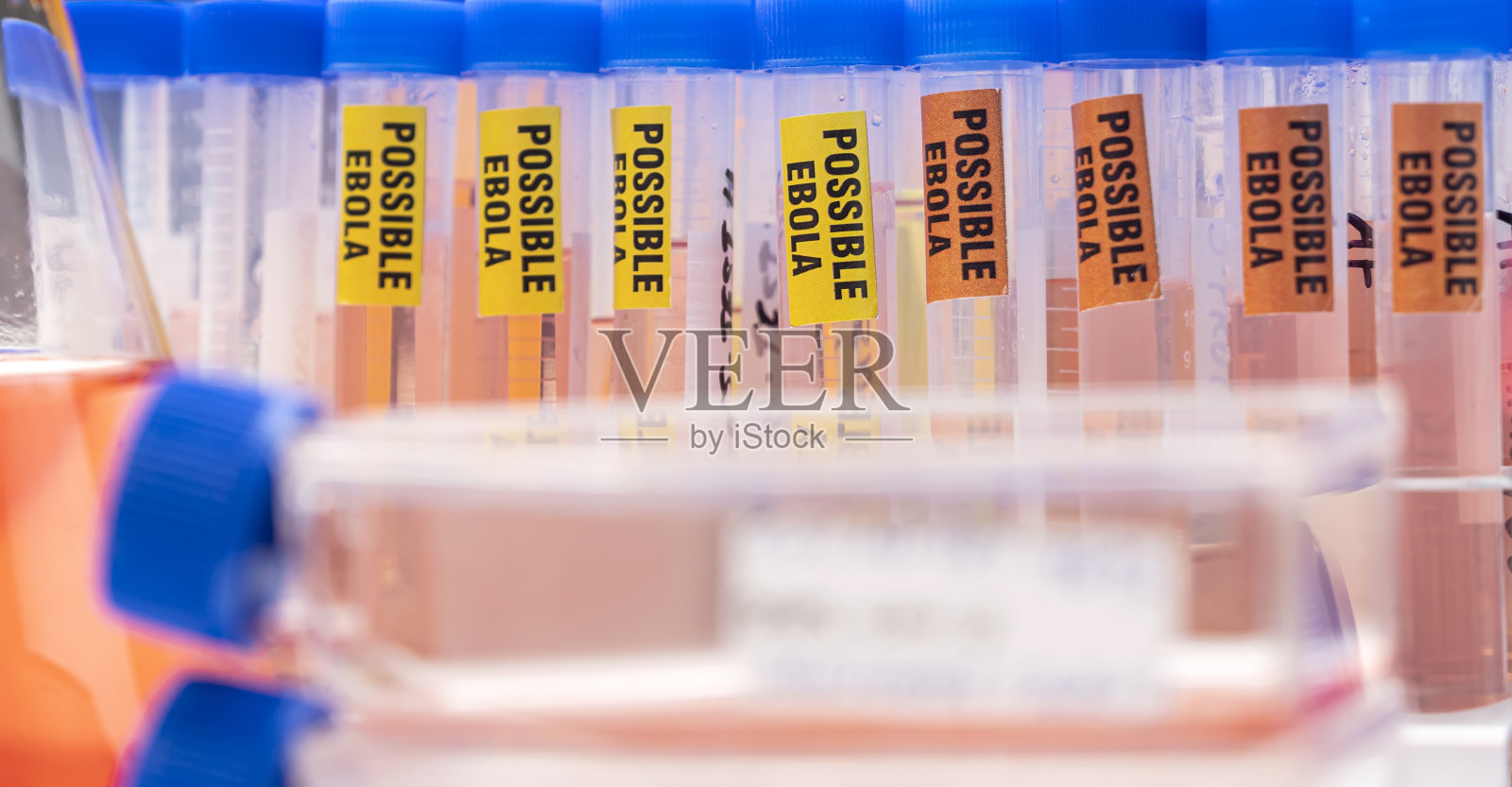 埃博拉患者血样，阳性结果，概念图像照片摄影图片