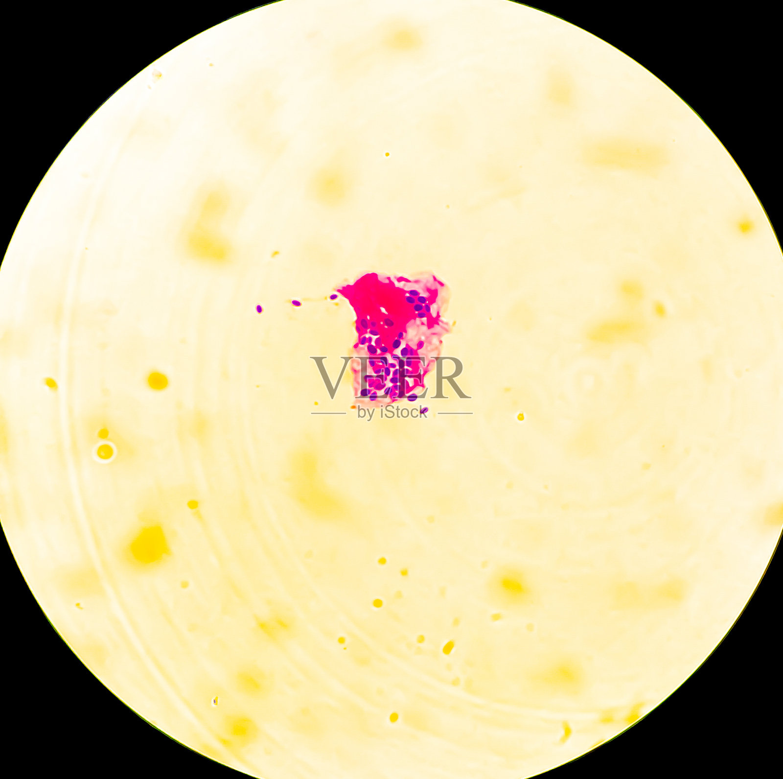 显微镜下的白色念珠菌。黄色的真菌照片摄影图片