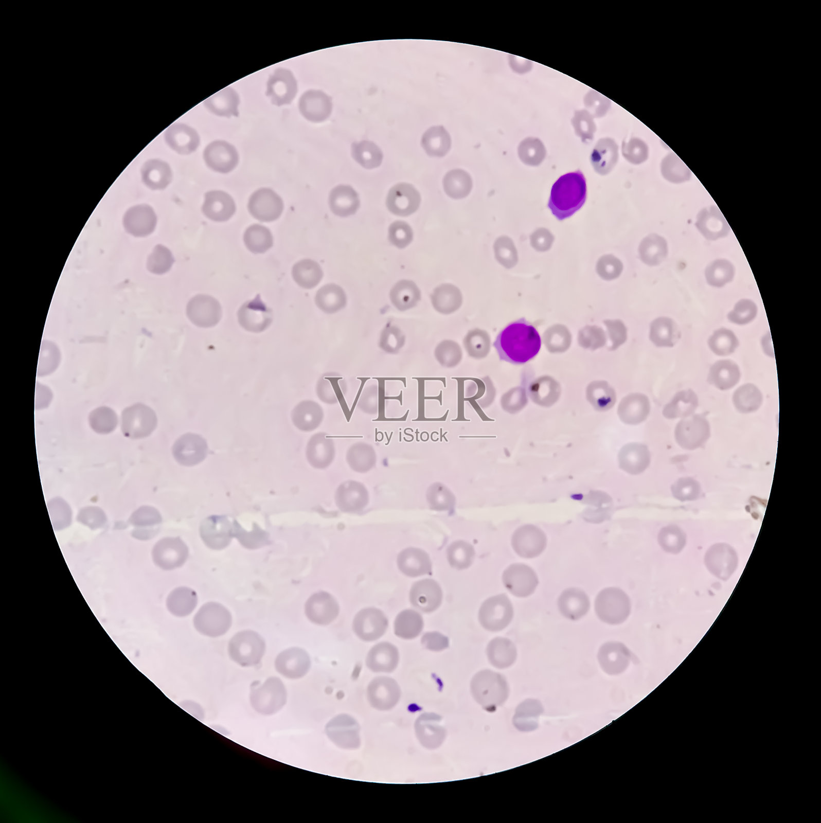 镜检血涂片或载玻片显示红细胞数量减少(RBC)，红细胞称为红细胞减少症、红细胞减少症。原发性红细胞减少症，100倍。特写镜头照片摄影图片